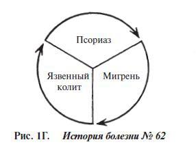 Мигрень