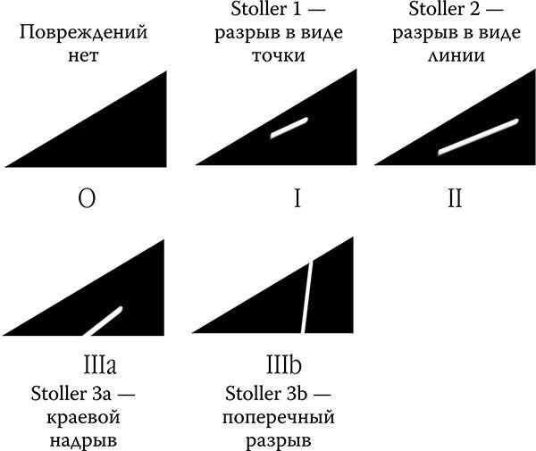 Как лечить спину и суставы