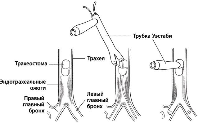 Хрупкие жизни. Истории кардиохирурга о профессии, где нет места сомнениям и страху