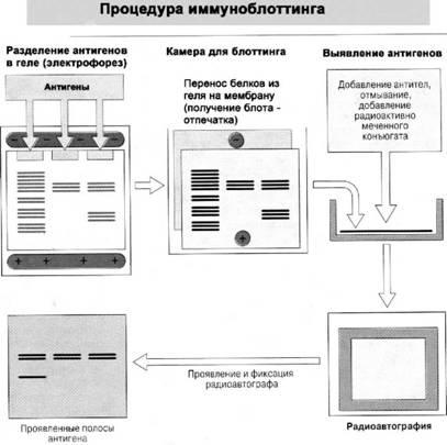 Имя ему СПИД. Четвертый всадник Апокалипсиса