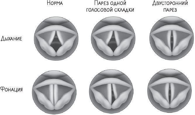 В лабиринтах уха, горла и носа. Скрытые механизмы работы, неочевидные взаимосвязи и полезные знания, которые помогут «дотянуть» до визита к врачу