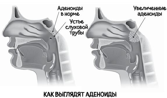 Почему болит горло. Першение, кашель, боль, храп – как не пропустить опасные симптомы