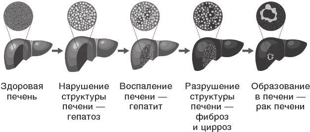 О чем молчит печень. Как уловить сигналы самого крупного внутреннего органа, который предпочитает оставаться в тени