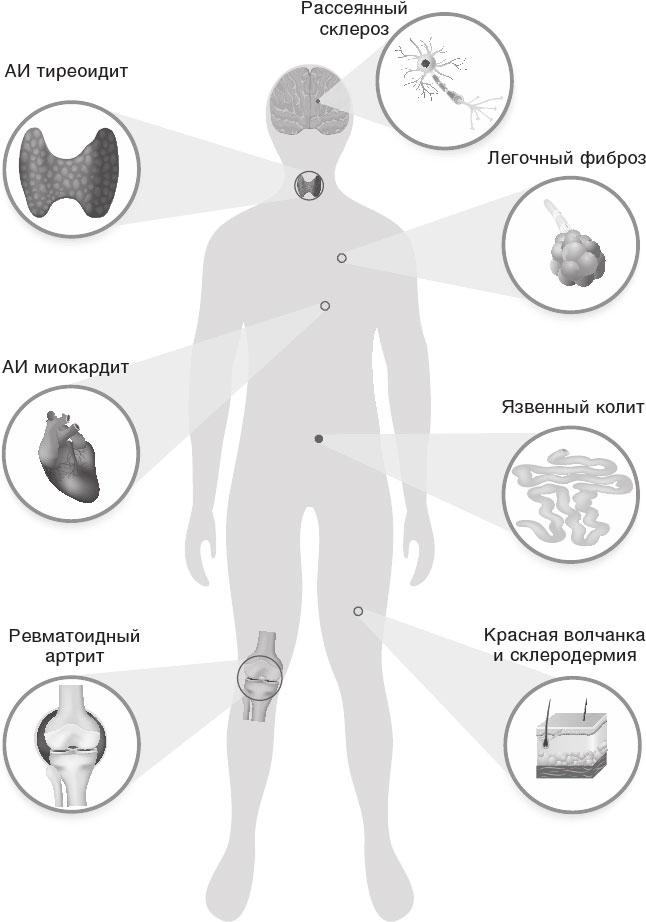 О чем молчит печень. Как уловить сигналы самого крупного внутреннего органа, который предпочитает оставаться в тени