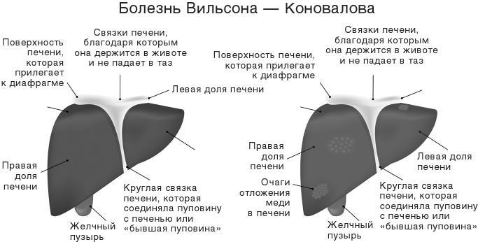 О чем молчит печень. Как уловить сигналы самого крупного внутреннего органа, который предпочитает оставаться в тени