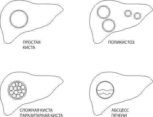 О чем молчит печень. Как уловить сигналы самого крупного внутреннего органа, который предпочитает оставаться в тени