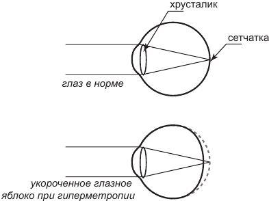 История очков, или Вооруженный взгляд